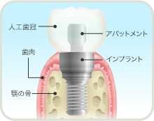 sonota_img_1 sonota_img_1